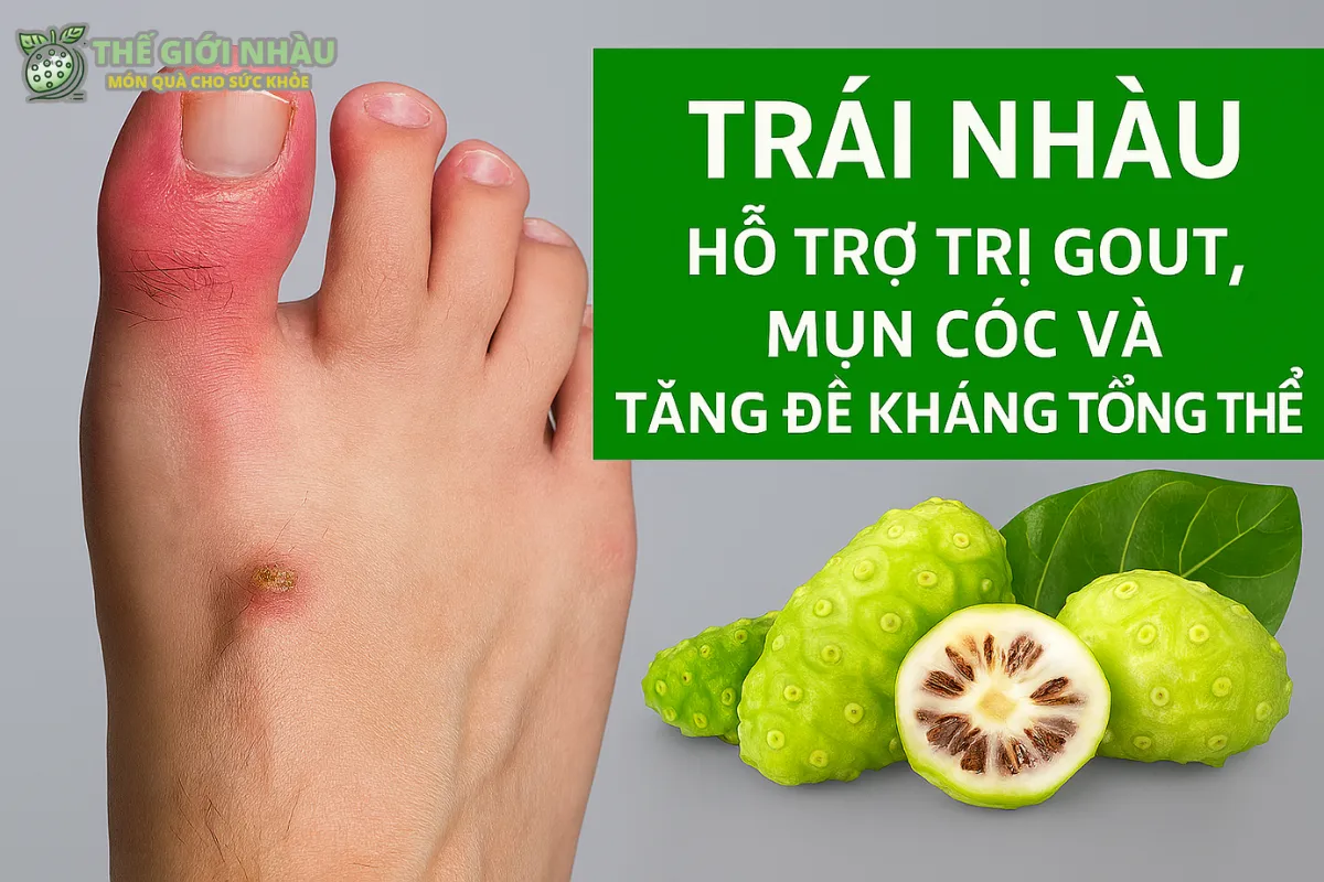 Trị Gout, Mụn Cóc Và Tăng Đề Kháng Tổng Thể